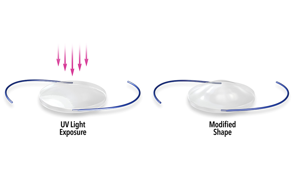 Product illustration of lens showing how UV light exposure modifies the shape of the lens